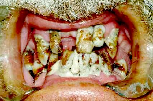 Anhang ID 2891 - Ekelige Zähne.jpg
